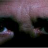 legion_72
